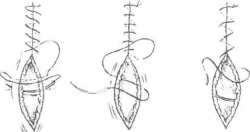 http://www.iacuc.msu.edu/training/Shared_Images/suture_simple_continuous.gif