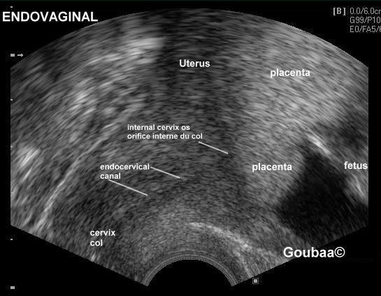 2DS00009_ultrasound_medicalecho_ultrasonography.JPG