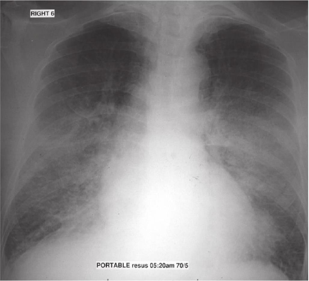 C:\Users\Administrator\Desktop\Chest X-Ray in Clinical Practice _ap_087.jpg
