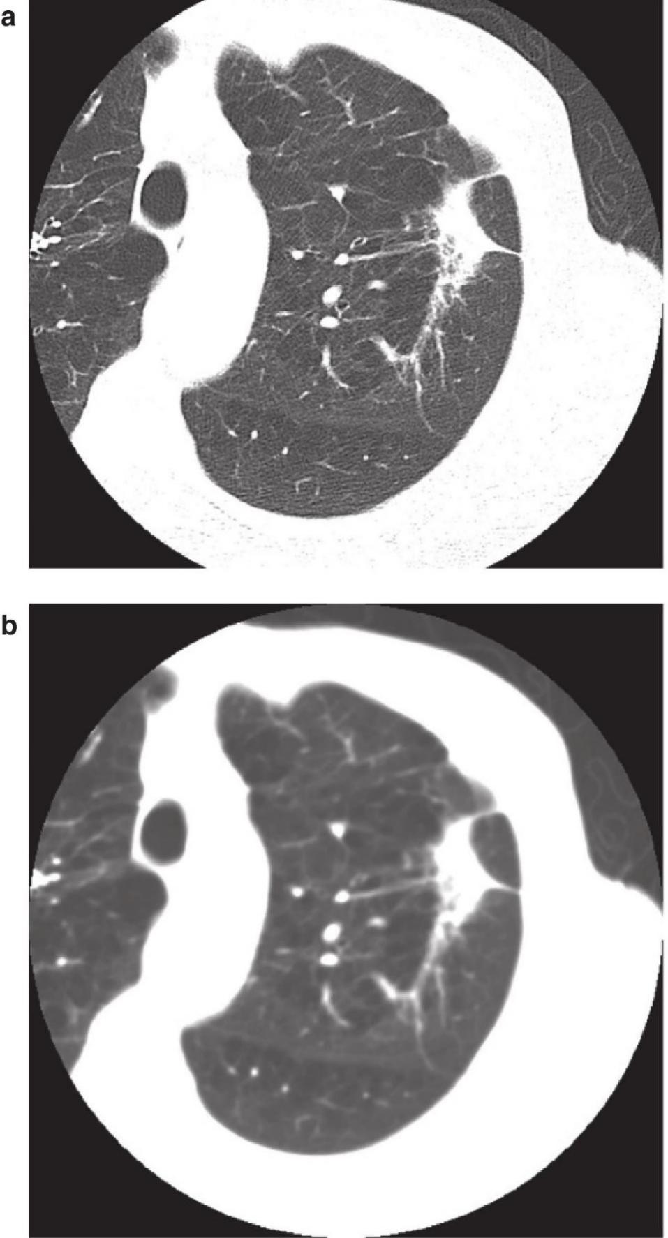 C:\Users\Administrator\Desktop\Chest X-Ray in Clinical Practice _ap_179.jpg