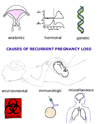 http://www.thenewjerseymiscarriagecenter.com/images/d_pregnancy_loss_01.gif