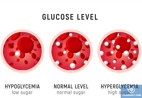 Có những yếu tố nguy cơ nào làm tăng khả năng mắc phải hội chứng tăng glucose máu?
