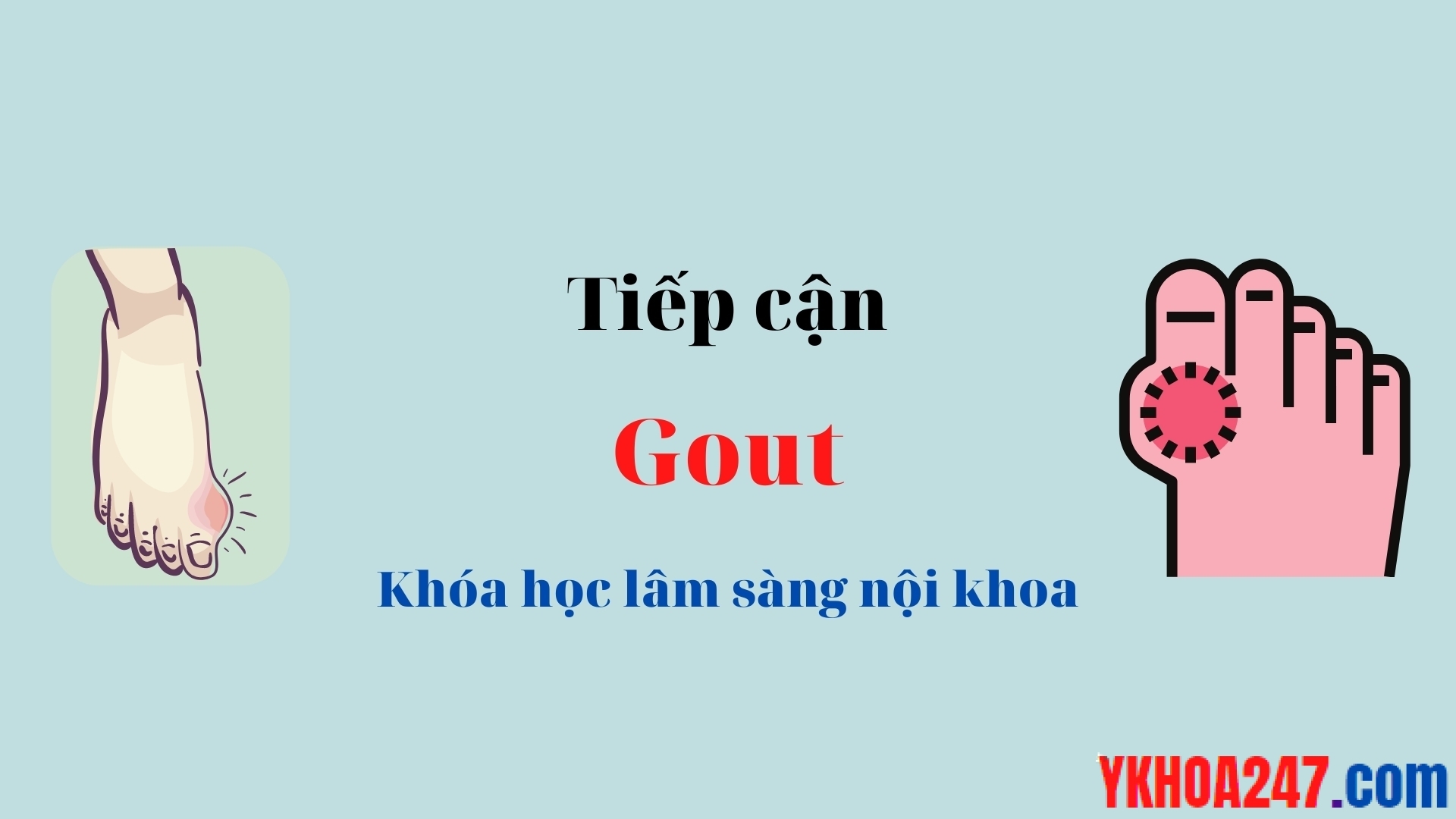 tiep can gout