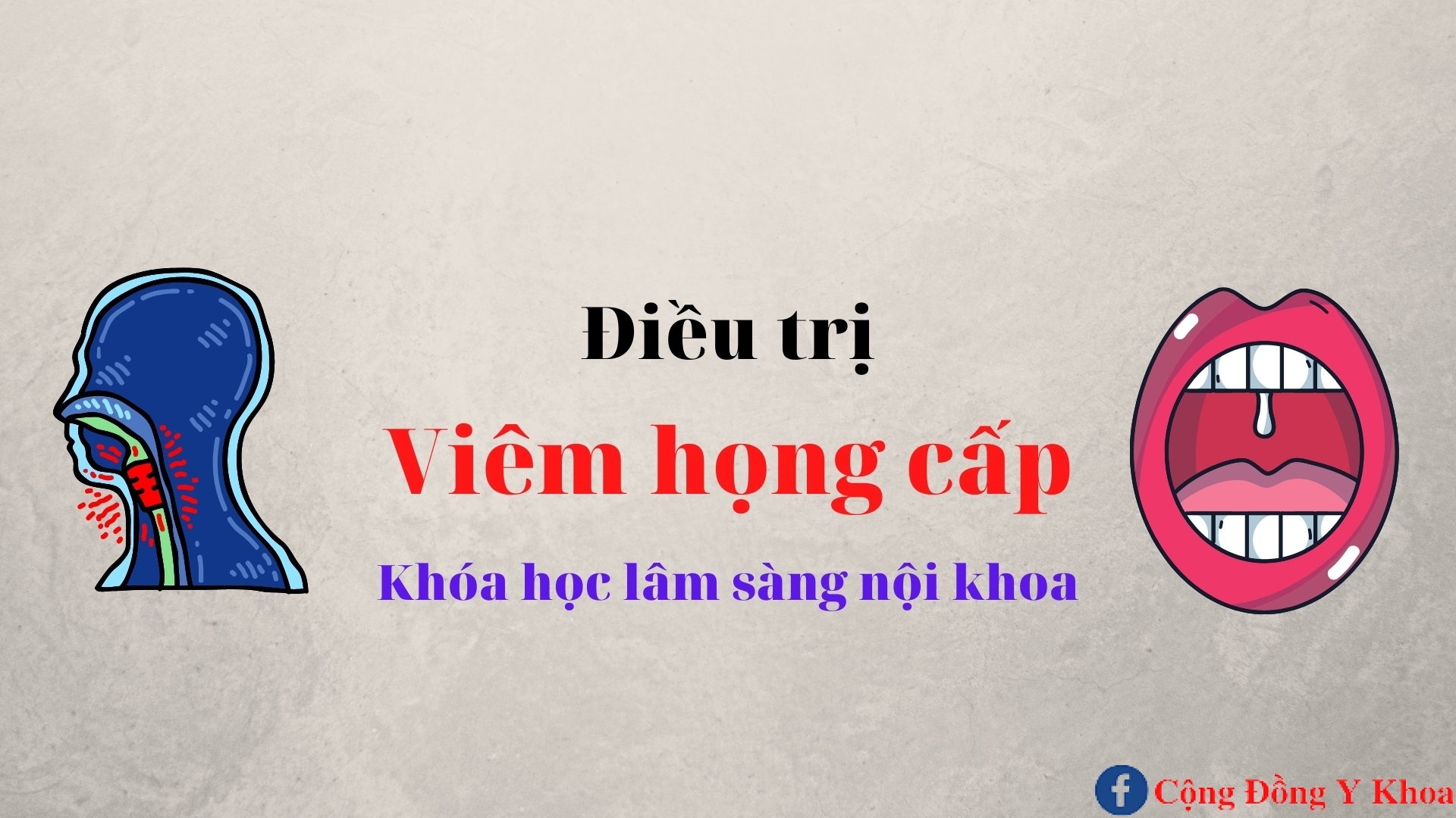 viem hong dieu tri